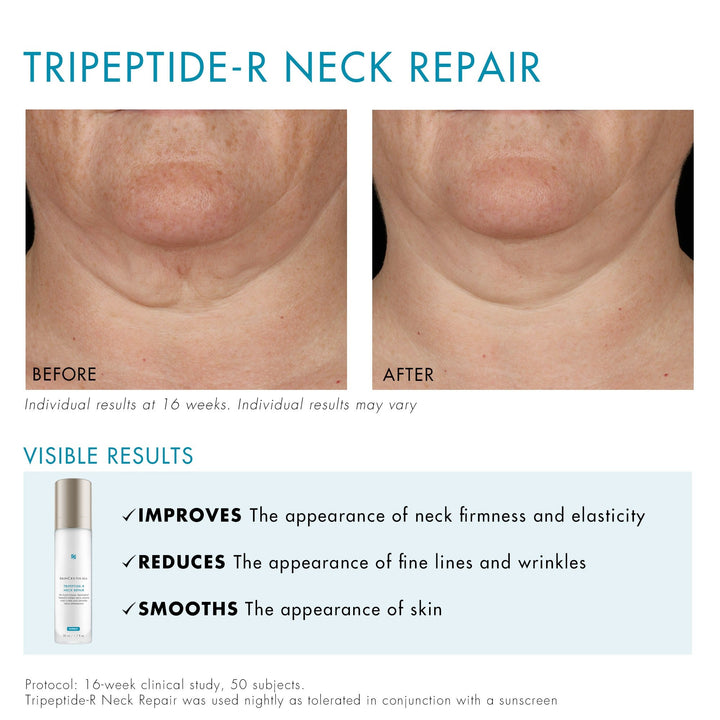 SkinCeuticals Tripeptide-R Neck Repair