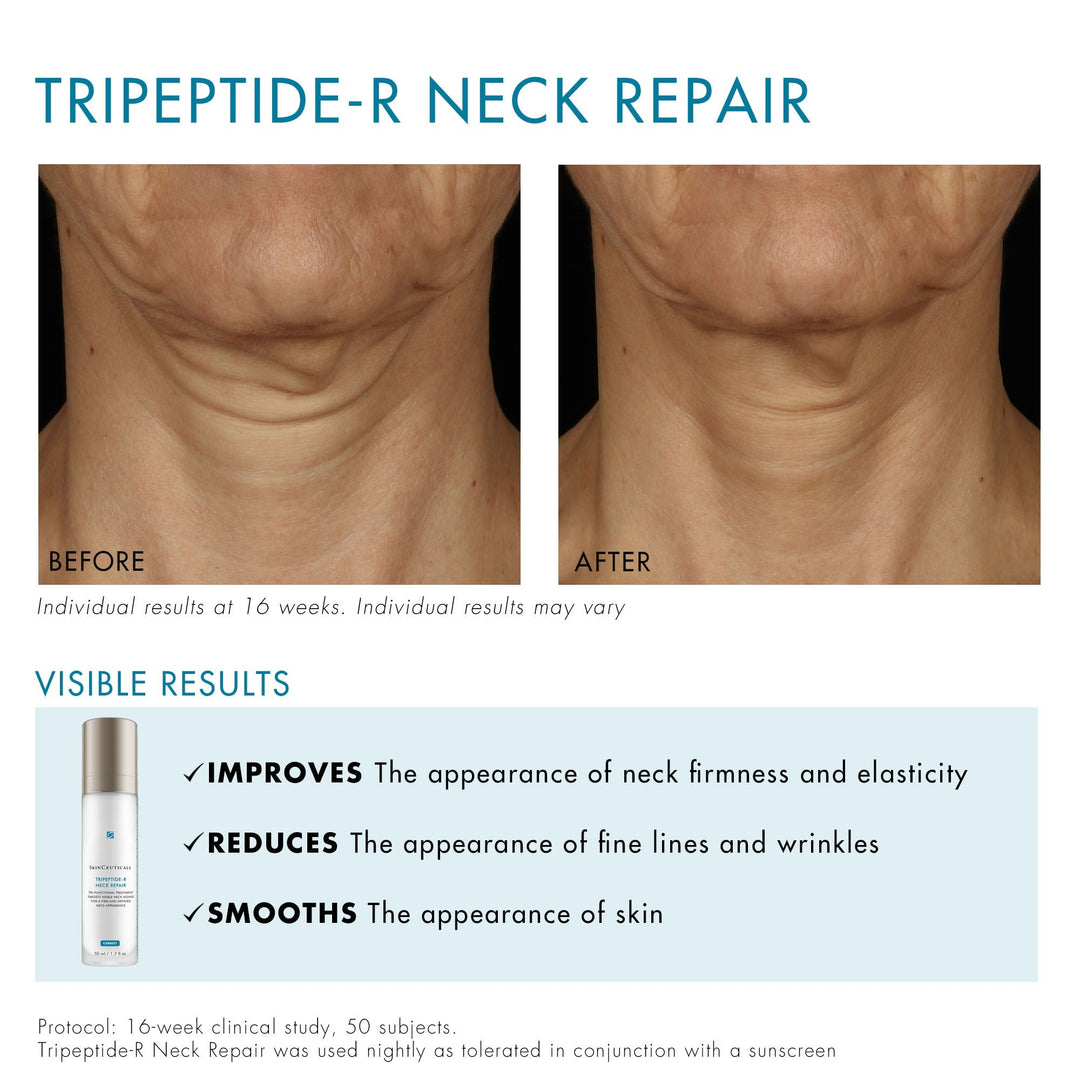 SkinCeuticals Tripeptide-R Neck Repair