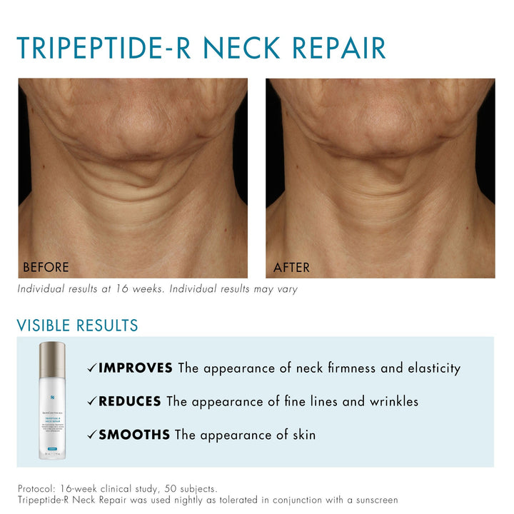 SkinCeuticals Tripeptide-R Neck Repair