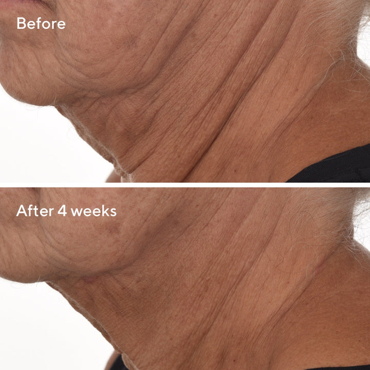 Retinal ReSculpt™ Overnight Treatment