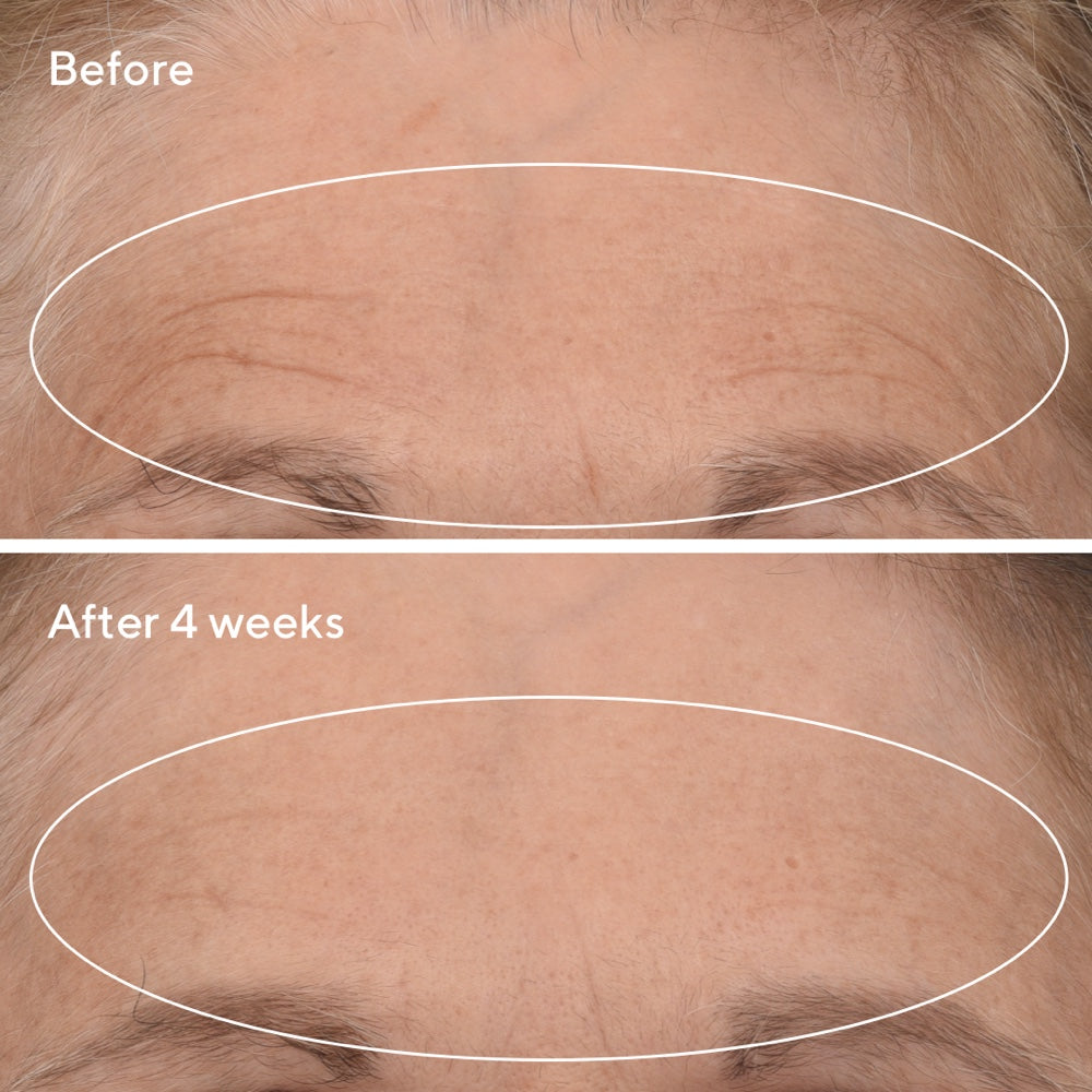 Retinal ReSculpt™ Overnight Treatment