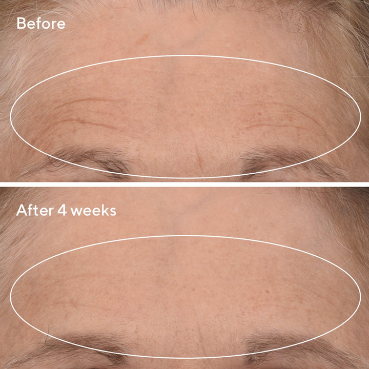 Retinal ReSculpt™ Overnight Treatment