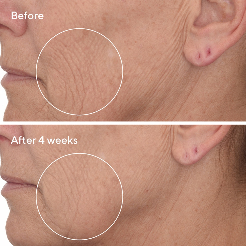 Retinal ReSculpt™ Overnight Treatment