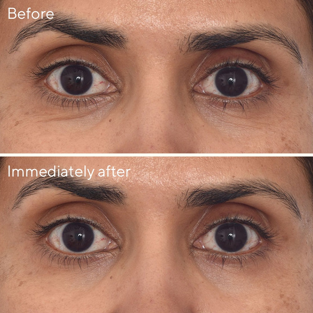 Retinol Youth Renewal  Eye Mask - Single Pack