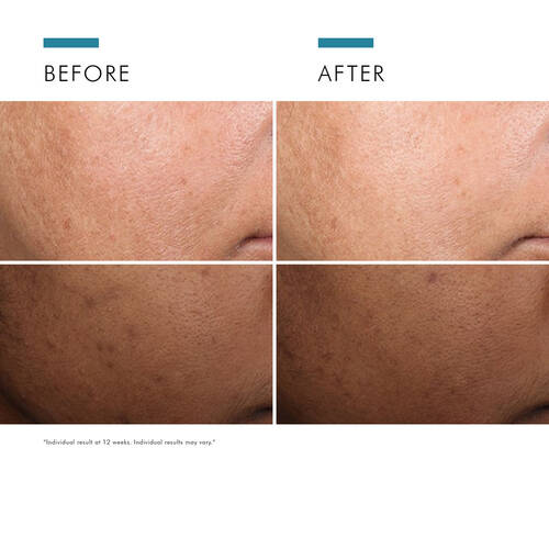 SkinCeuticals Discoloration Defense Serum