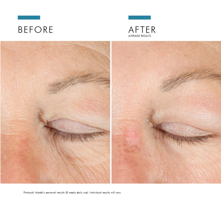 SkinCeuticals A.G.E. Advanced Eye