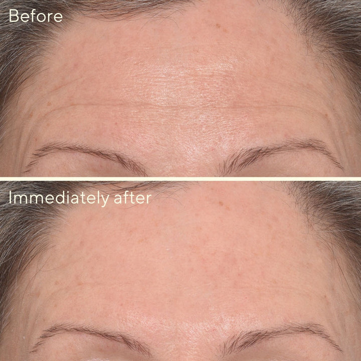 Targeted Wrinkle Corrector