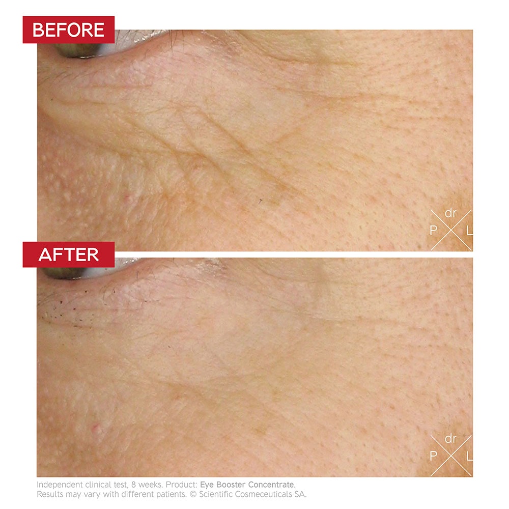 Dr LEVY Switzerland Eye Booster Concentrate