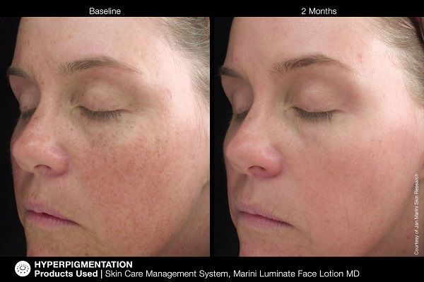 Jan Marini Luminate Face Lotion